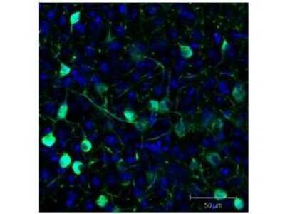 Tissue: Sf-1:Cre mice crossed to the Z/EG reporter line. Mouse brain (coronal view, 20X magnification). Fixation: 4%PFA/PBS with o/n fixation, and subsequently transferred to a 30% sucrose solution. Antigen retrieval: frozen in OCT freezing medium (Sakura) and cryostat sectioned at 40 microns. Primary antibody: Goat anti-GFP was used at 1:500 dilution in free floating immunohistochemistry to detect GFP. Secondary antibody: Fluorochrome conjugated Anti-goat IgG secondary antibody was used for detection at 1:500 at 1:10,000 for 45 min at RT. Localization: Sf-1+ neurons and their processes of the ventromedial nucleus of the hypothalamus. Staining: eGFP as green fluorescent signal and sections were counterstained with DAPI.